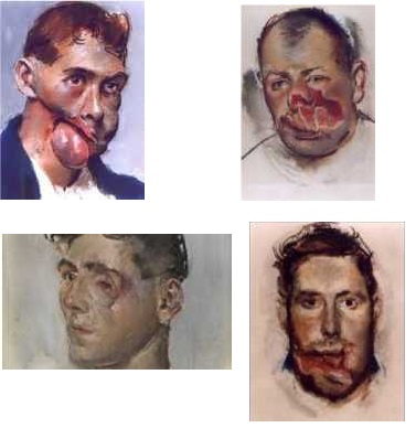 8 Henry Tonks Faces of Battle 1916