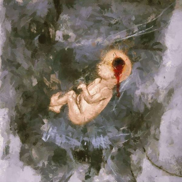 4 Wissam Al Jazairy Fetus from Syria