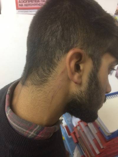 Οργανωμένη ρατσιστική επίθεση σε Αφγανό πρόσφυγα