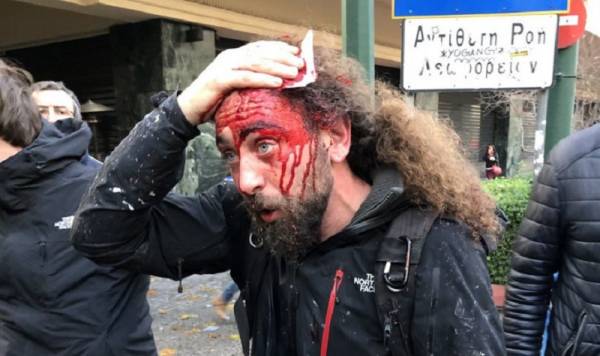 «Μακεδονομάχοι» έστειλαν στο νοσοκομείο φωτορεπόρτερ και έσπασαν τα δόντια εικονολήπτη