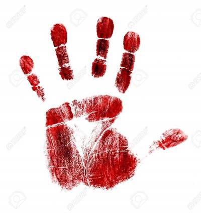 Βάφουν τα χέρια τους με αίμα, τα διευθυντικά &amp; συνδικαλιστικά παράσιτα της Deutsche Telekom!