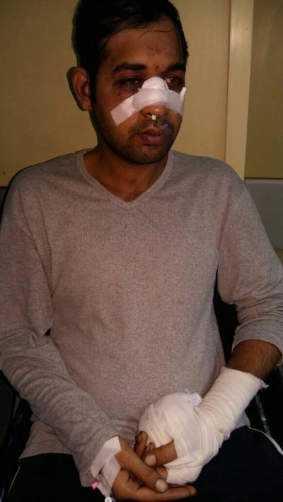 ΚΕΕΡΦΑ: Ρατσιστική επίθεση φασιστοειδών κατά μετανάστη εργαζόμενου σε εστιατόριο στην Λαμπρινή