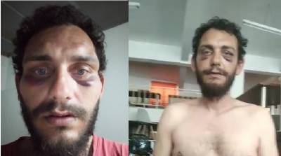 Ηράκλειο: Άγρια βία και ρατσισμός αστυνομικών με θύμα πολίτη – Τον πέρασαν για Πακιστανό και τον “σάπισαν”!