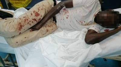 Άγρια ρατσιστική επίθεση κατά μετανάστη κοντά στο Πάντειο Πανεπιστήμιο