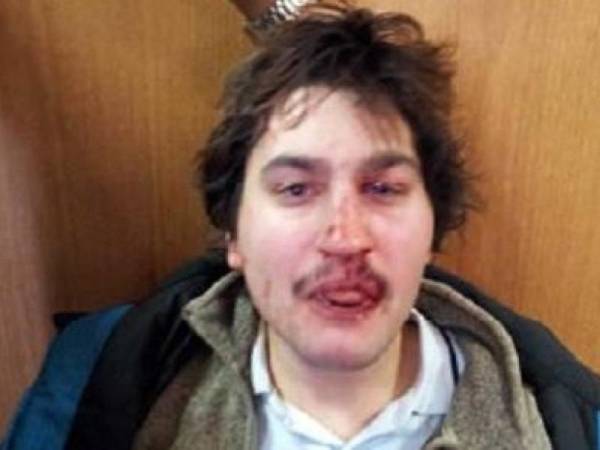 Κ.Ε.Δ.Δ.Α. : Να ικανοποιηθεί το αίτημα του απεργού πείνας Γιάννη Μιχαηλίδη για την αποφυλάκιση που δικαιούται