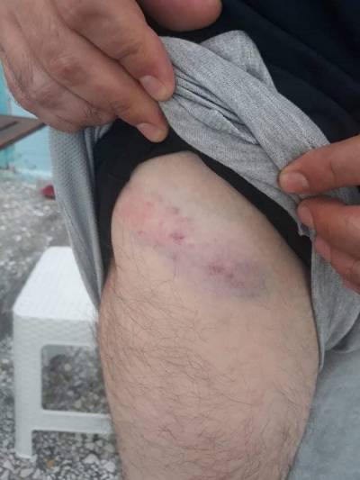 Ομάδα κρατουμένων Κορυδαλλού: Καταγγελία για τραυματισμούς από την εισβολή της ΟΑΕΕ στα κελιά κρατουμένων