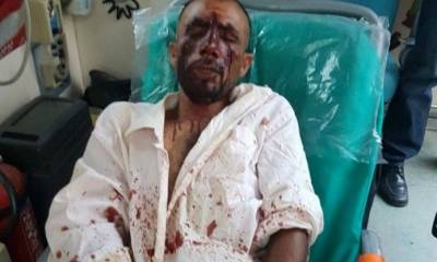 ΑΝΤΑΡΣΥΑ: Δελτίο Τύπου για τη χρυσαυγίτικη επίθεση στον Ασπρόπυργο