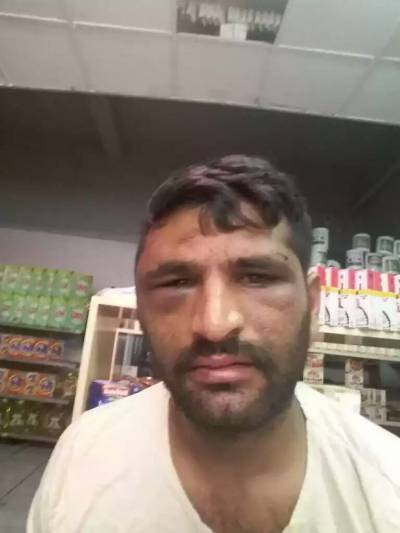 ΚΕΕΡΦΑ: Νέες επιθέσεις της φασιστικής συμμορίας στη Γκορυτσά Ασπροπύργου με την Αστυνομία απρόθυμη να ασχοληθεί